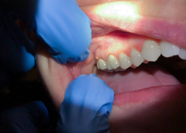 Best Emergency Care for Gum Disease in Crane, TX